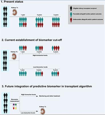 Pretransplant characteristics of kidney transplant recipients that predict posttransplant outcome